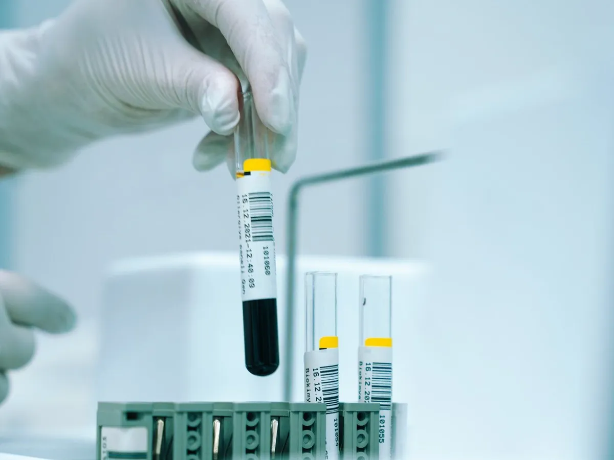 A gloved hand lifts a labeled tube of blood from a rack of sample tubes in a lab